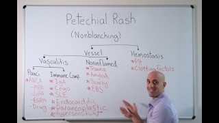 Petechial Rash  Approach [upl. by Eimaj518]