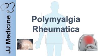 Symptoms of Coronavirus Disease 2019 [upl. by Thgiwd249]