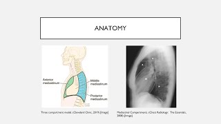 Mediastinal Masses [upl. by Tima32]