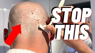 How To STOP CUTTING YOURSELF When Shaving Your Head [upl. by Synn]