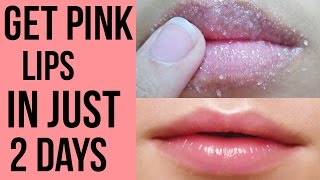 How to get pink lips Lighten dark lips naturally at home Get Rid Of Chapped Lips [upl. by Adnawad]