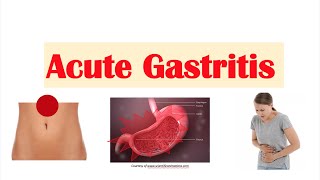 10 Signs amp Symptoms of Gastrointestinal Cancer  Stomach CancerDrNanda Rajaneesh  Doctors Circle [upl. by Violante]