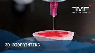 What Is 3D Bioprinting  The Medical Futurist [upl. by Evy]