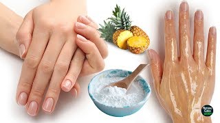 How To Remove Wrinkles From Hands Naturally in 2 Days [upl. by Mackay]