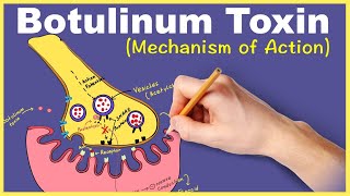 Myasthenia Gravis Nursing NCLEX Review Symptoms Treatment Pathophysiology Interventions [upl. by Zahavi]