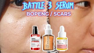 SERUM TERBAIK UNTUK BOPENG  SCARS [upl. by Icnan941]