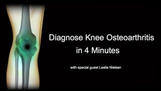 Diagnose Knee Osteoarthritis in 4 Minutes with Leslie Nielsen [upl. by Dric]