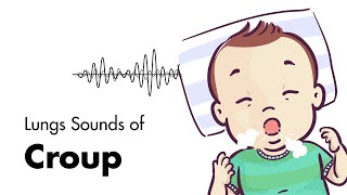 Sounds of Croup Laryngotracheitis  Lung Sounds  MEDZCOOL [upl. by Setiram100]