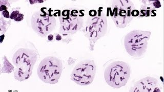 Stages of Meiosis [upl. by Arodnap]