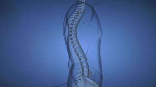 Spine Disease Kyphosis [upl. by Edva]