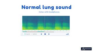 Normal lung sound [upl. by Camellia352]