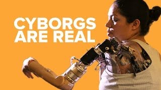 Real Life Cyborgs You Didnt Know Existed [upl. by Aicala47]