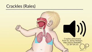 Respiratory Assessment by B Leary L DelSignore  OPENPediatrics [upl. by Nnayllehs]