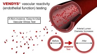 VENDYS  Endothelial Function Measurement Explained [upl. by Anairam]