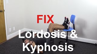 How to fix lordosis and kyphosis together [upl. by Lehcyar44]