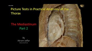 Picture Tests in Anatomy  Thorax  Mediastinum 2 [upl. by Kipper857]