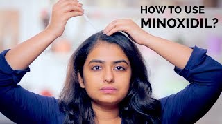 How To Use Minoxidil  Hair Regrowth  Skin Diaries [upl. by Guod]