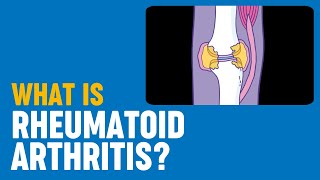 Psoriatic Arthritis Overview  Johns Hopkins Medicine [upl. by Ehcram883]