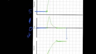 Ventilator Mode amp Waveforms Review [upl. by Hasila]