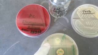 DNase Test Staphylococcus aureuspositive [upl. by Narud]