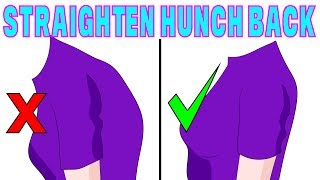 The 4 minute solution to correct hunchback kyphosis [upl. by Ardnola]