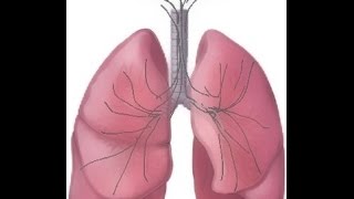 BREATH SOUNDS Stages of Fluid Overload Pneumonia [upl. by Arag]