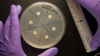 ID Laboratory Videos Antibiotic susceptibility testing [upl. by Sirois]