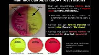 Mannitol Salt Agar MSA  Results amp Theory [upl. by Ennylyak]