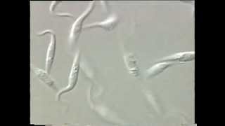 Trypanosoma [upl. by Drhacir966]