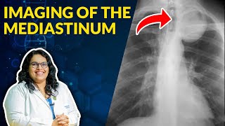 Imaging of Mediastinum Radiological Anatomy  Dr Avni Skandhan MD [upl. by Codding]