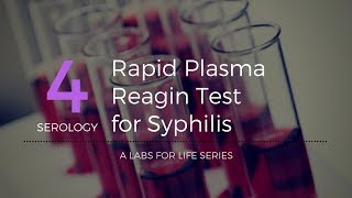 Rapid Plasma Reagin Test for Syphilis [upl. by Nivag]