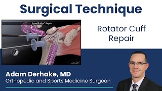 Rotator Cuff Repair Surgical Technique [upl. by Adon]