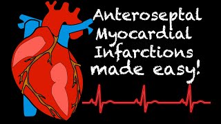 EMS Cardiology  Tachy Tuesday Anteroseptal Myocardial Infarction STEMI [upl. by Guendolen]