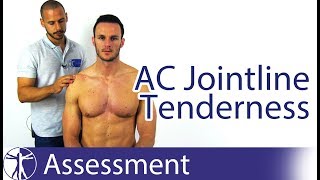 Acromioclavicular  AC joint mobilizations [upl. by Winchell]