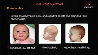 CriduChat Syndrome  Usmle step 1 lecture [upl. by Eiromem]