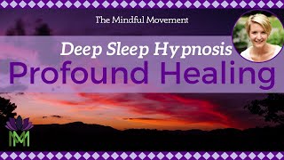 Use Your Powerful Mind Healing Deep Sleep Hypnosis  Mindful Movement [upl. by Binni]