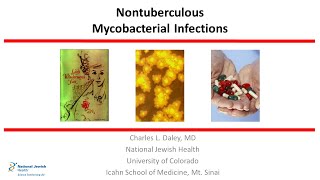 Nontuberculous Mycobacterial Infections 2019 [upl. by Aplihs368]