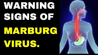 MARBURG VIRUS  HISTORY SYPTOMS TRANSMISSION CONSEQUENSES PREVENTION TREATMENT AND TESTING [upl. by Edlyn]