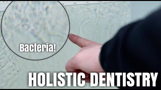 What is Holistic Dentistry [upl. by Mecke]