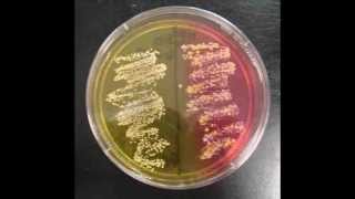 How to Interpret Mannitol Salt Agar Bacterial Growth Medium [upl. by Arrik]