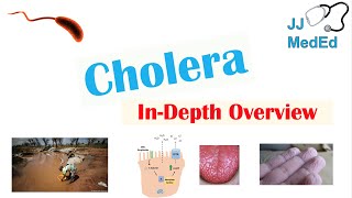 Cholera Vibrio Cholerae Pathophysiology Risk Factors Symptoms Diagnosis and Treatment [upl. by Henrieta]