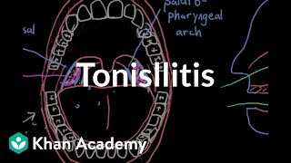 Symptoms of Strep Throat [upl. by Hyacintha]