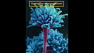 Parasitologie Lexplication la plus facile de laspargillose [upl. by Idnahs]