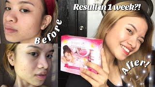 BRILLIANT SKIN REJUVENATING SET 1 WEEK HONEST REVIEW ✨ [upl. by Coleman]