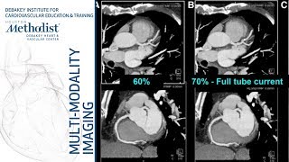 Cardiac CT Current Technology amp Principles Faisal Nabi MD FACC September 11 2018 [upl. by Airahs]