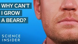 Why Some Men Cant Grow Beards [upl. by Naimed]