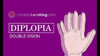 Double Vision  Diplopia See Real patients getting results with Functional Neurology amp FCR [upl. by Audly]