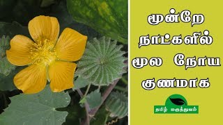 மூன்றே நாட்களில் மூல நோய் குணமாக  Thuthi ilai uses in Tamil  Abutilon Indicum for Piles [upl. by Nosretep]