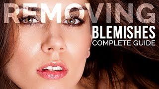 Complete Guide to Removing Blemishes in Photoshop [upl. by Eneiluj]