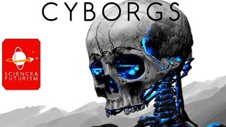 Cyborgs [upl. by Pius373]